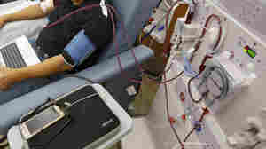 Hispanic dialysis patients are more at risk for staph infections, the CDC says