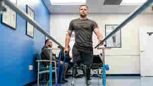 Ukrainian soldiers benefit from U.S. prosthetics expertise but their war is different