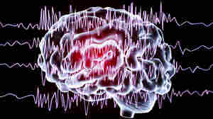 Lasers, robots, and tiny electrodes are transforming treatment of severe epilepsy