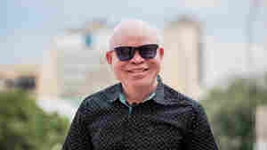 He's a singer, a cop and the inspiration for a Netflix film about albinism in Africa