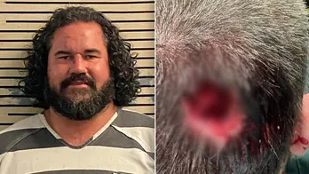 Florida man bit chunk out of deputy's head during assault at music festival: sheriff's office