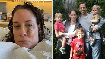 Melanoma patients reveal dramatic stories for Skin Cancer Awareness Month: ‘I thought I was careful’