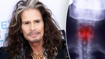 Steven Tyler’s career-ending throat injury: How dangerous is a fractured larynx?