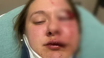 Woman just dropped off by Uber brutally beaten in random attack